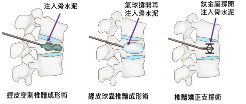 edb160b96ae70d1a51bad1c3a64a2c66.png